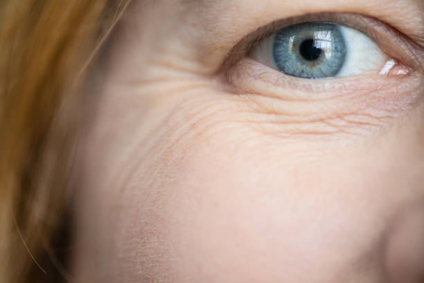 Eye Bag Removal: How to Identify a Safe Treatment Environment