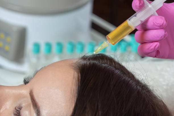 PRP Hair Treatment Travel and Activity Guidance After Your Appointment