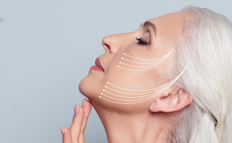 Why Thread Lifts Are Growing in Popularity in Islamabad