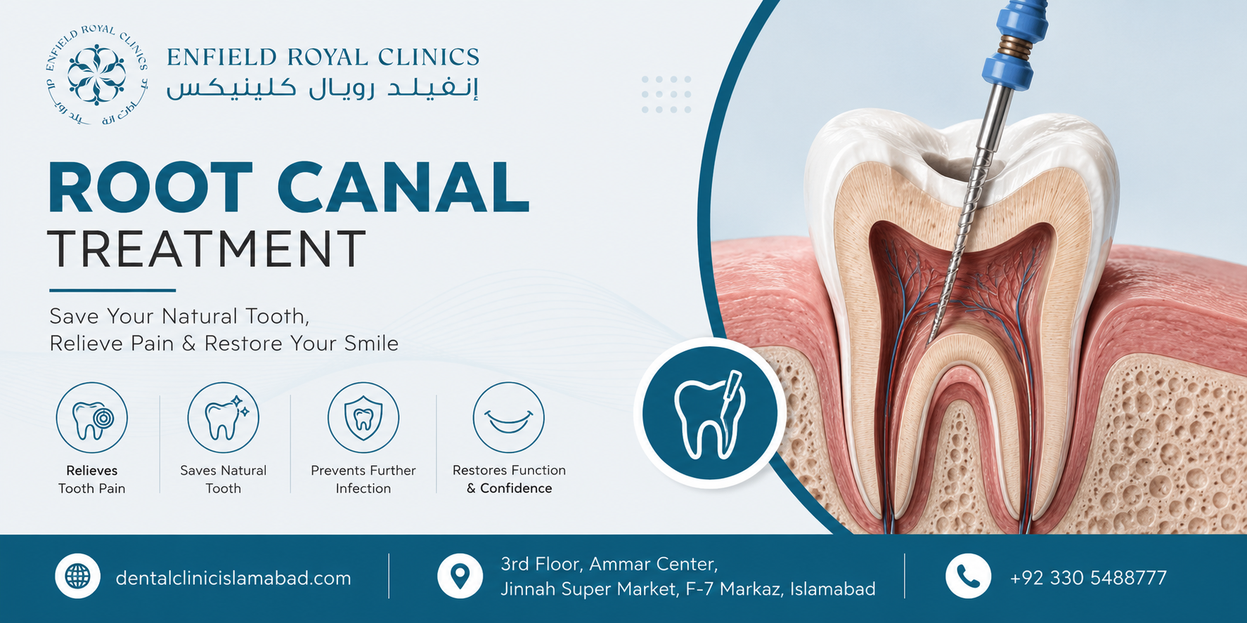 Modern Dental Care for Long-Term Oral Health Root Canal Treatment in Islamabad Pakistan:
