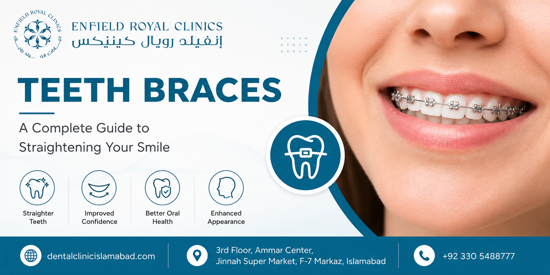 Why Teeth Braces in Islamabad Pakistan Are Important for Adults Too: