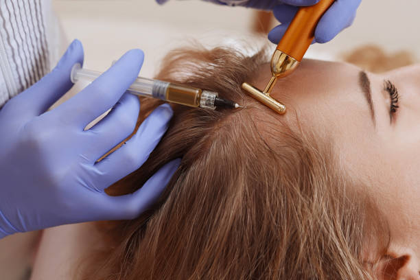 How Blood Sugar Imbalance Affects Hair Growth and Follicle Health PRP Hair Treatment in Islamabad: