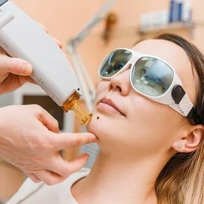 What Is The Most Effective Removal?