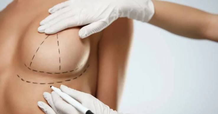 Breast Lift Surgery in Islamabad vs Breast Reduction Surgery: Which Is Right for You?