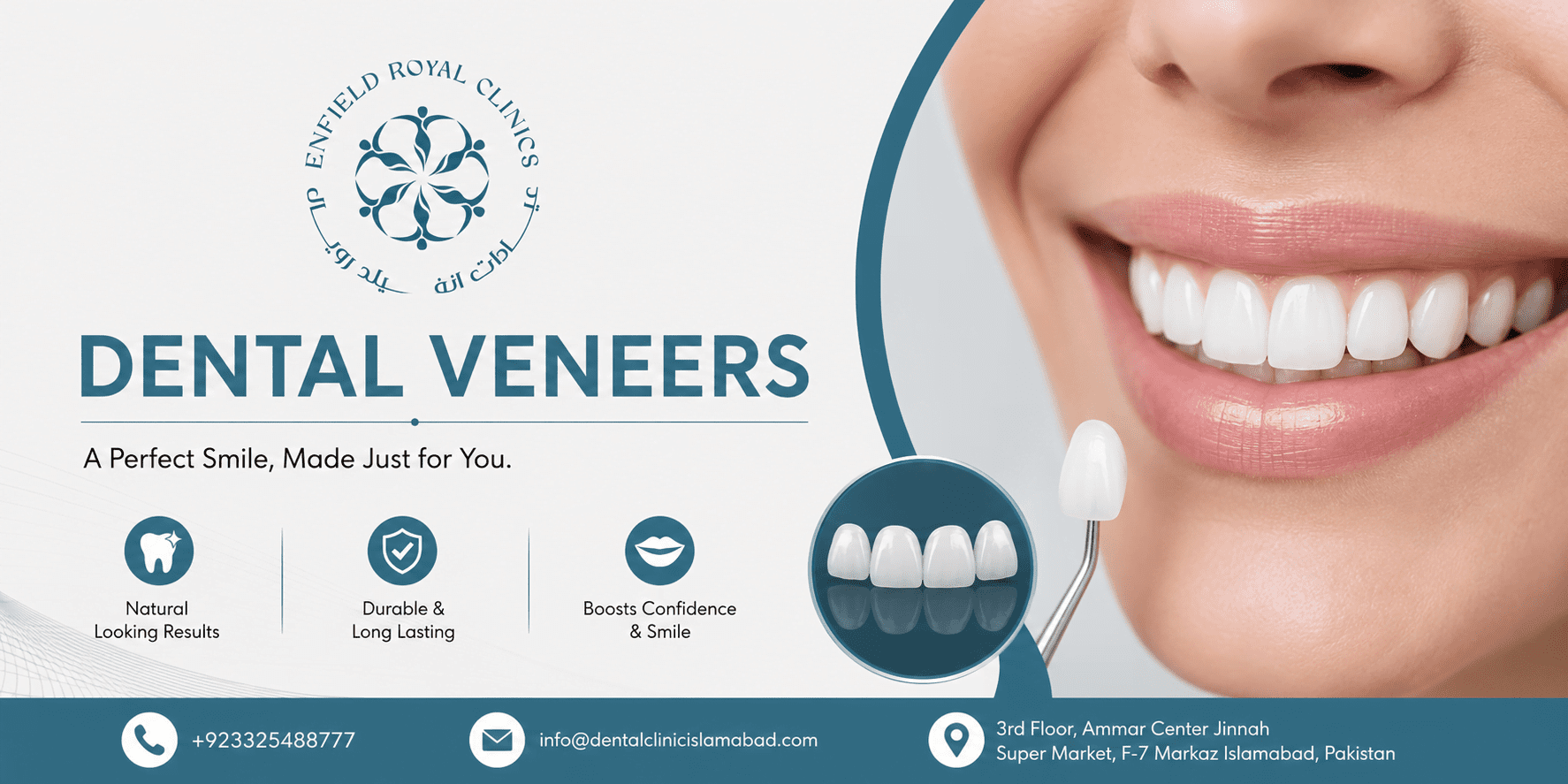 Dental Veneers in Islamabad for Flawless Smile Design