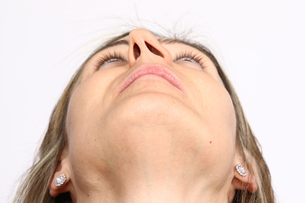 What Factors Matter When Choosing a Deviated Septum Surgery Clinic?