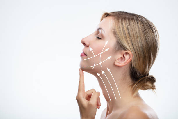 Endolift FAQs answered for people considering laser tightening