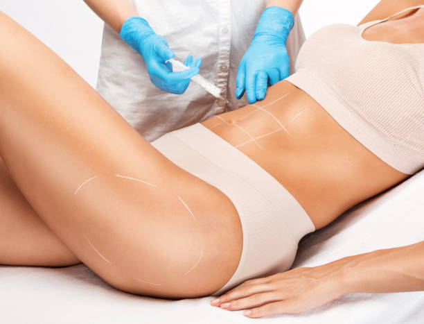 How hormones and metabolism impact Fat Melting Injections success