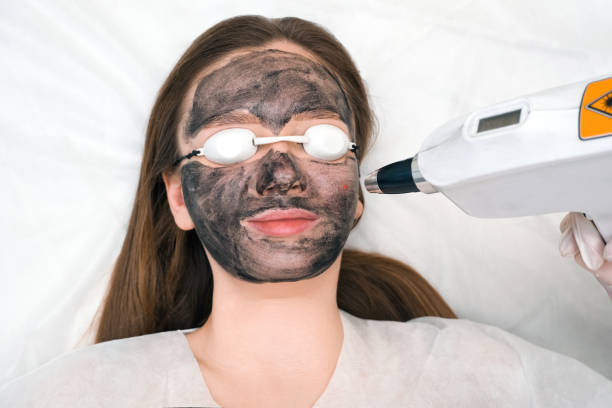 Spectra laser carbon peel long term maintenance and follow up tips