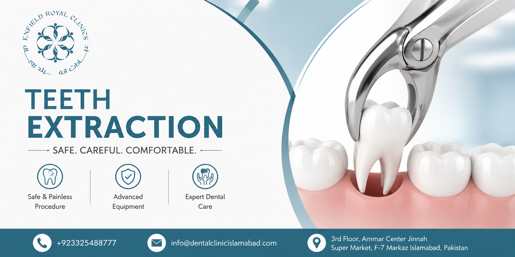 Teeth Extraction in Islamabad Backed by Expert Dental Care