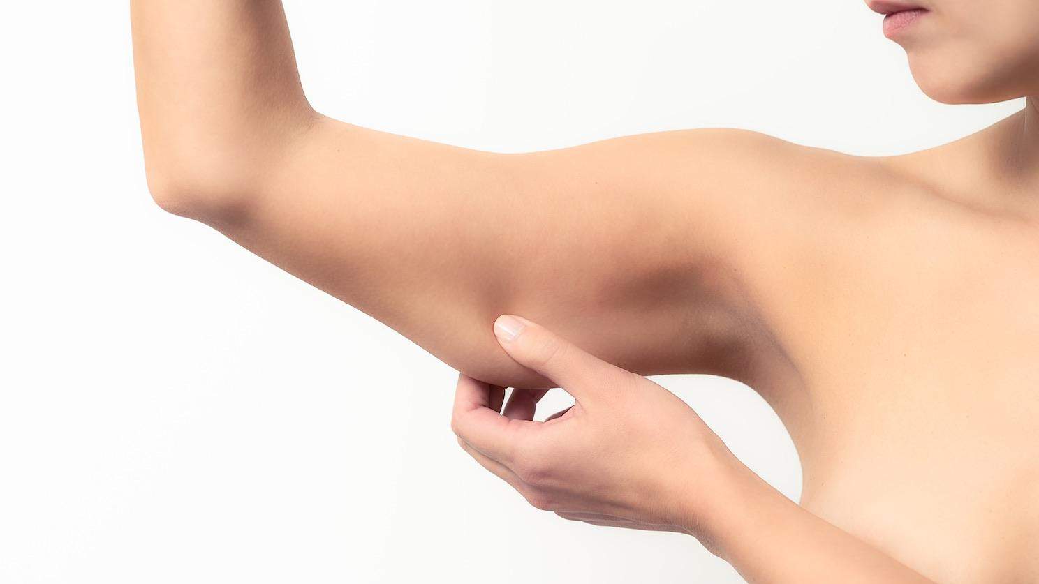 Top 5 Clinics for Arm Lift Surgery in Dubai