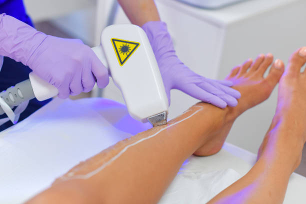Laser Hair Removal Side Effect Management: When to Seek Professional Help
