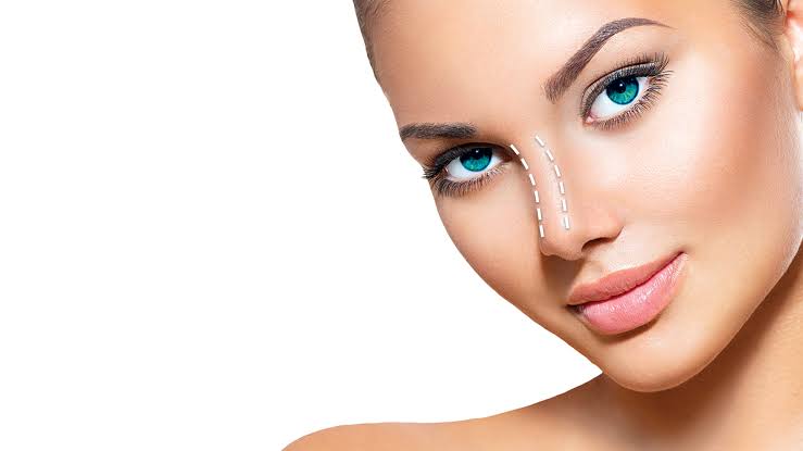 Can Alarplasty Achieve Refined Nasal Proportions for Harmony?