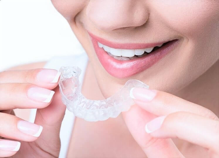 Aligners in Dubai: A Complete Guide to Clear Teeth Straightening