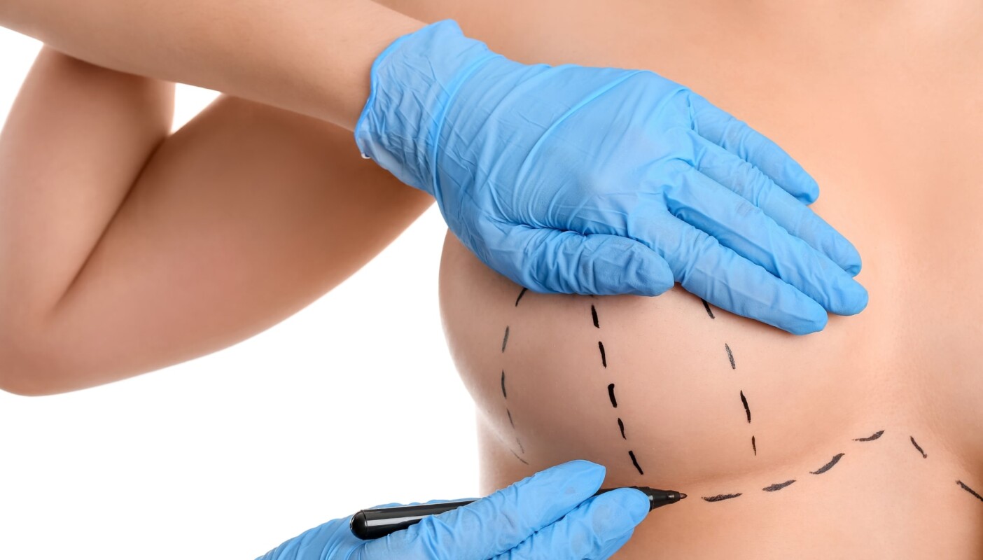 Breast Augmentation in Islamabad: How to Prepare for Your Consultation