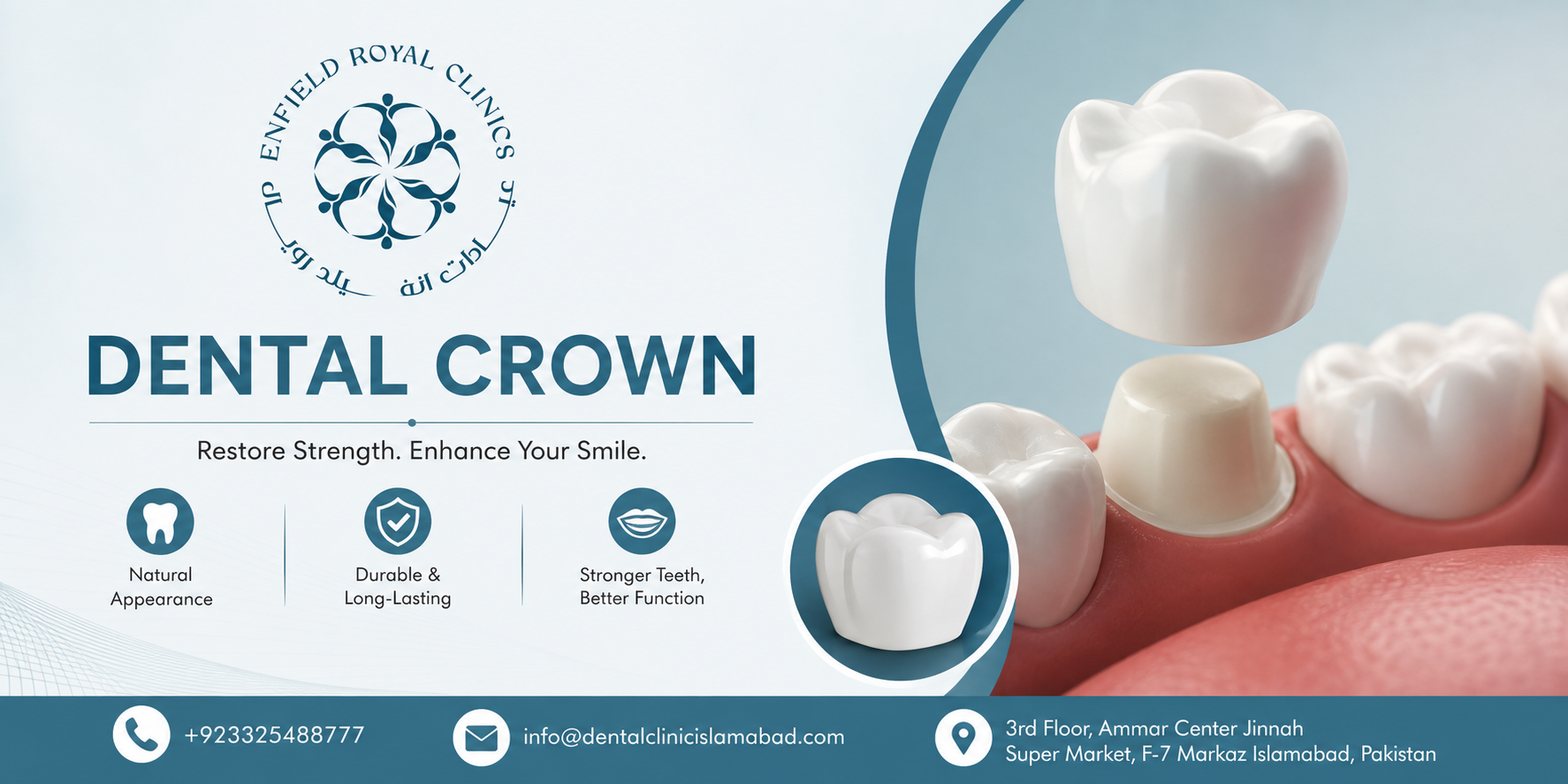 Restore Your Teeth With Custom Crowns in Islamabad