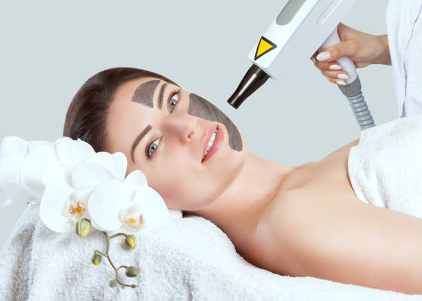 Is Laser Carbon Peel Effective for Oily and Congested Skin?