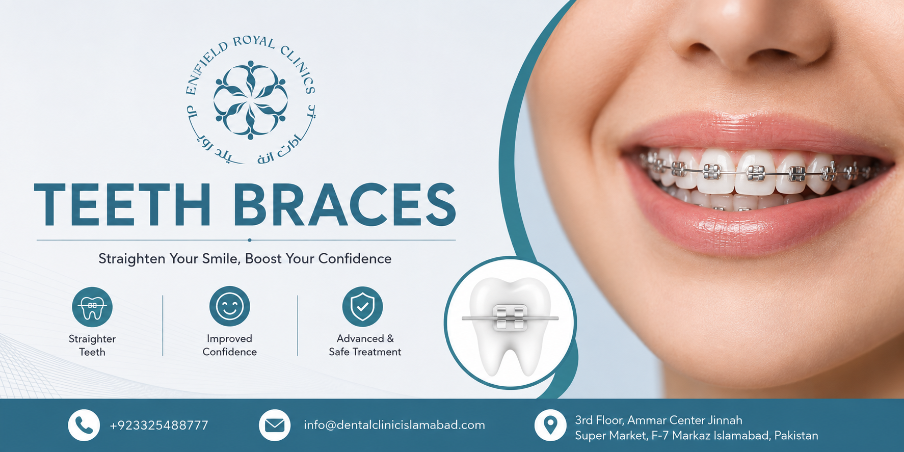 Expert Orthodontic Treatments with Teeth Braces in Islamabad