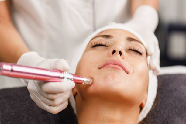 DermaPen Guide for First-Time Microneedling Patients